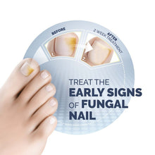 Load image into Gallery viewer, Scholl Fungal Nail Treatment